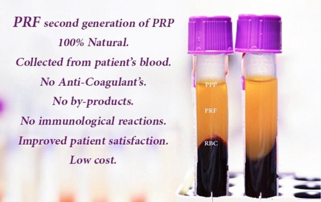 A purple tube of blood with the words " prp 1 0 0 % natural ".
